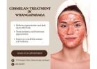 Cosmelan Skin Peels Auckland | Professional Pigmentation Experts