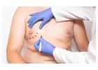 Gynecomastia and Liposuction Surgery: Do You Need Both?