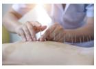 Acupuncturist in Adelaide | Natural Pain Relief & Wellness Care at Yihong Acupuncture
