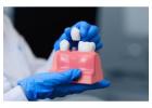 Best Dental Implants Melbourne for a Confident Smile
