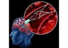 Stenting Treatment Ahmedabad with Advanced Diagnostic Support