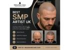 Best SMP Artist UK | Leading Scalp Micropigmentation Specialist