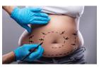 Tummy Tuck Specialist Near Me
