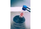 PRP And Stem Cells Treatment In Marina Del Rey