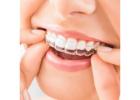 Demystifying Dental Implant Costs: What You Need to Know