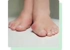 Bunion Surgery South Amboy