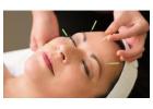 Natural Facial Acupuncture for Skin Care 