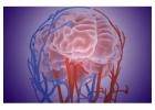 Exploring Modern Aneurysm Brain Surgery Options?