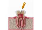 Trusted Cosmetic Dentistry in New York from Experienced Brooklyn Dental Experts